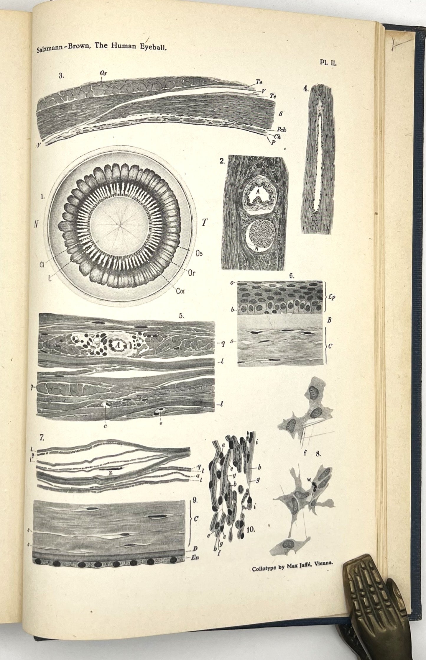 BOOKS - ANATOMY AND HISTOLOGY OF THE HUMAN EYEBALL IN THE NORMAL STATE,